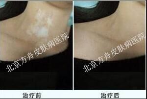 刘女士康复案例(图1) 刘女士康复案例(图1)