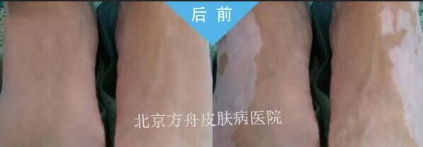 贾某康复案例(图1) 贾某康复案例(图1)
