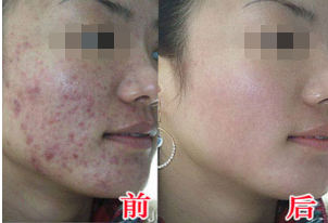 黄玲玲康复案例(图1)