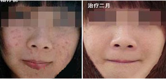 莹莹康复案例(图1)