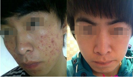 小林康复案例(图1)