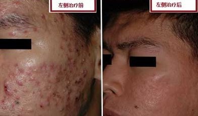 小贾康复案例(图1)